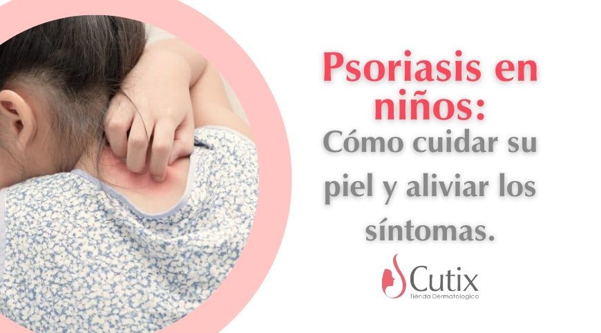 Psoriasis en niños: Cómo cuidar su piel y aliviar los síntomas.